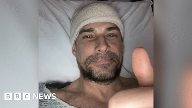Protein film actor Craig Russell 'lucky' to see film after brain tumour